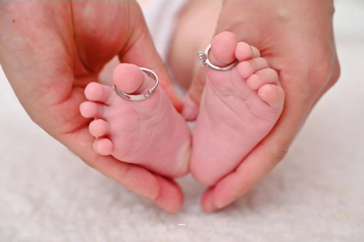 大连孕妇怎样预防妊娠纹